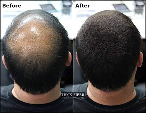 THICK FIBER - Hair Fibers for Thinning Hair (Black) 25g Bottle, Hair Loss concealer for Men & Women