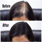 THICK FIBER - Hair Fibers for Thinning Hair (Black) 25g Bottle, Hair Loss concealer for Men & Women