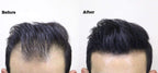 THICK FIBER - Hair Fibers for Thinning Hair (Black) 25g Bottle, Hair Loss concealer for Men & Women