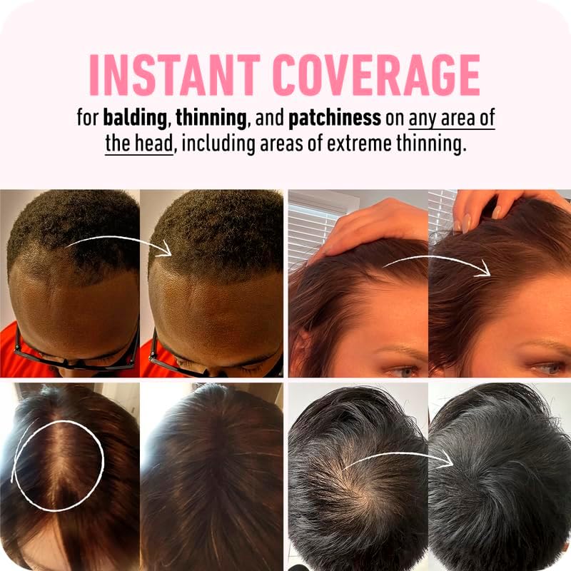 BOLDIFY Hairline Powder, Instantly Conceals Hair Loss and Fills In Receding Hairlines, and Wide Parts, Stain-Proof 48 Hour Formula for Hair & Beard, Root Concealer & Gray Hair Coverage (Light Brown)
