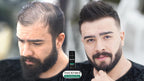 THICK FIBER - Hair Fibers for Thinning Hair (Black) 25g Bottle, Hair Loss concealer for Men & Women