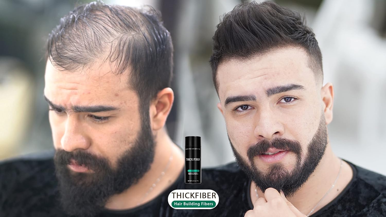 THICK FIBER - Hair Fibers for Thinning Hair (Black) 25g Bottle, Hair Loss concealer for Men & Women