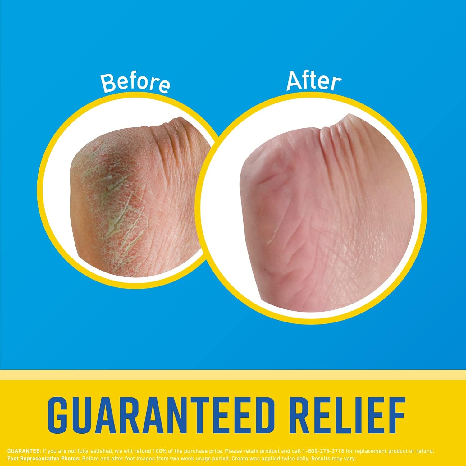 O'Keeffe's Healthy Feet Exfoliating Foot Cream, 3 ounce Tube