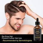 Soti Minoxidil 5% Hair Growth, Hair Loss Regrowth Serum. Made in USA! Dermatologists Recommended. Ginseng and Biotin Extra Strength Formula. (1 Pack)