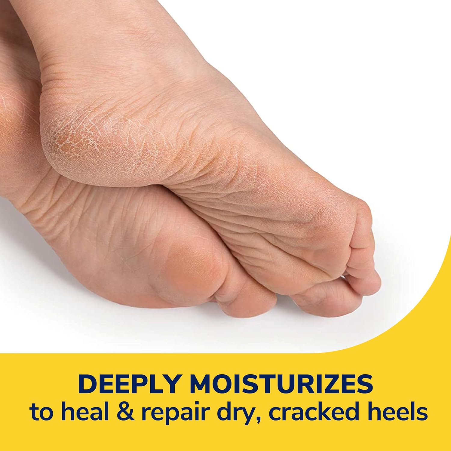 Dr. Scholl's Severe Cracked Heel Repair-Restoring Balm 2.5oz